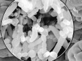 Gut Flora & Obesity
