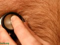 Heart attacks and cholesterol- Purely a question of diet