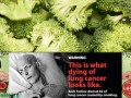 Lung Cancer Metastases and Broccoli