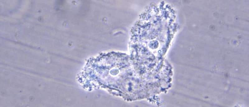 Preventing Bacterial Vaginosis with Diet