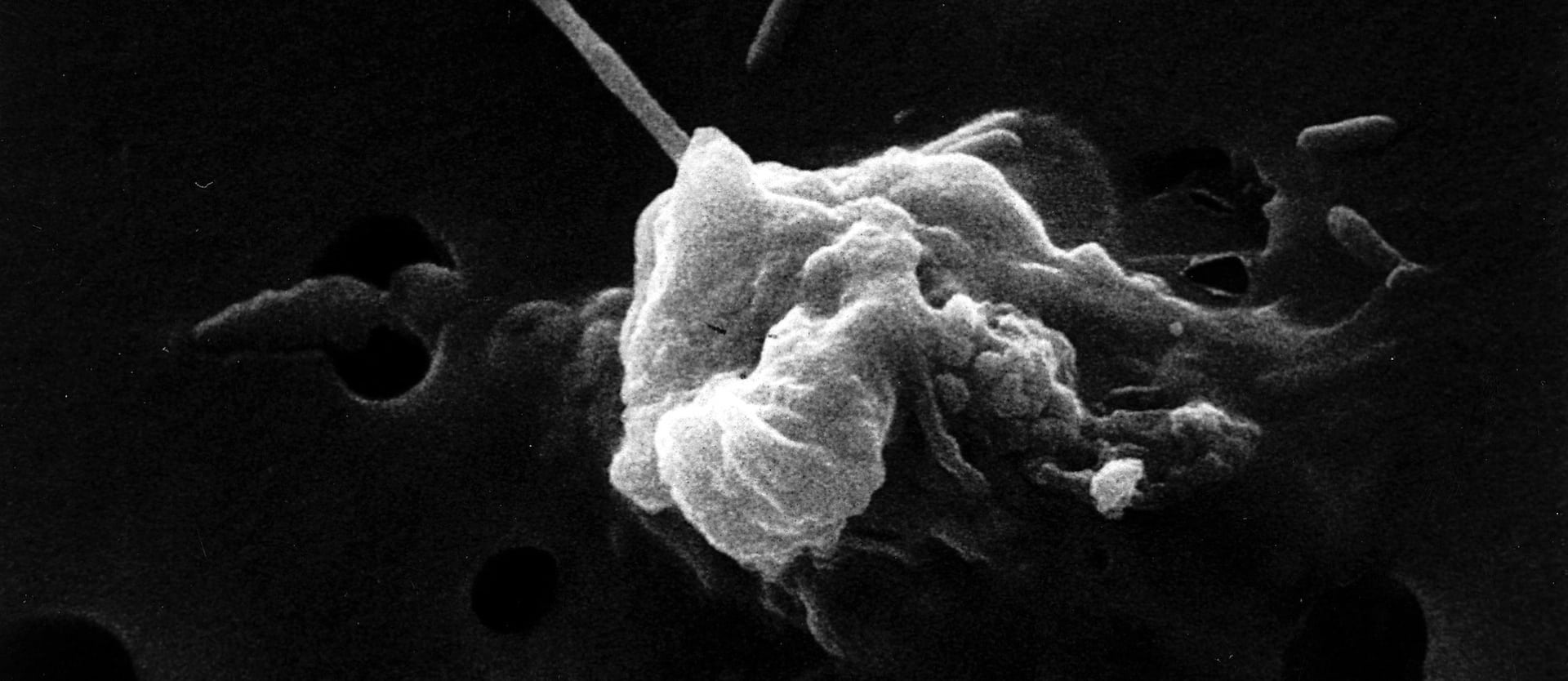 Turmeric Curcumin Reprogramming Cancer Cell Death