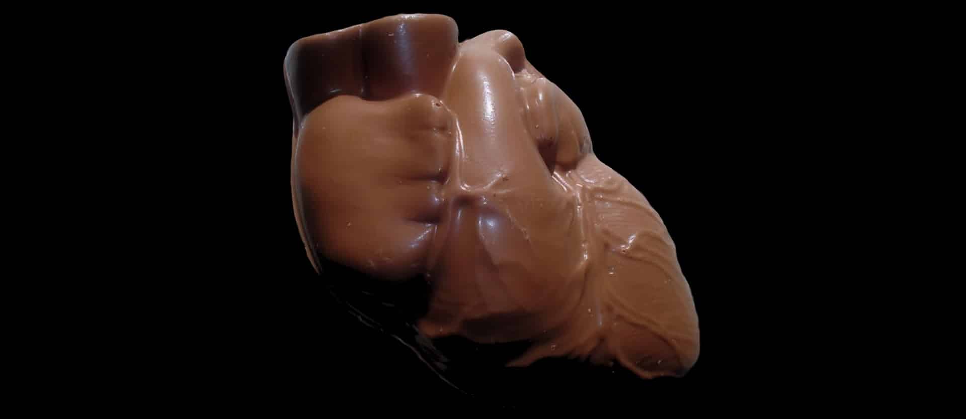 Dark Chocolate and Artery Function