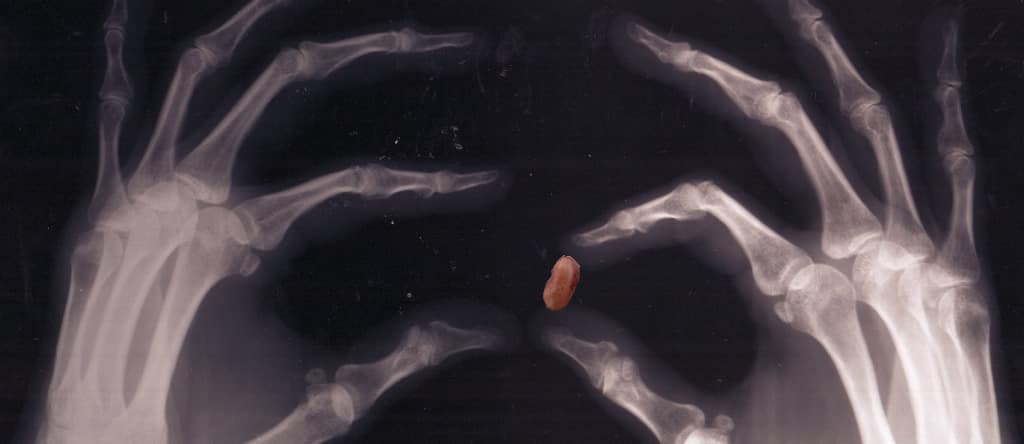 How Beans Help Our Bones