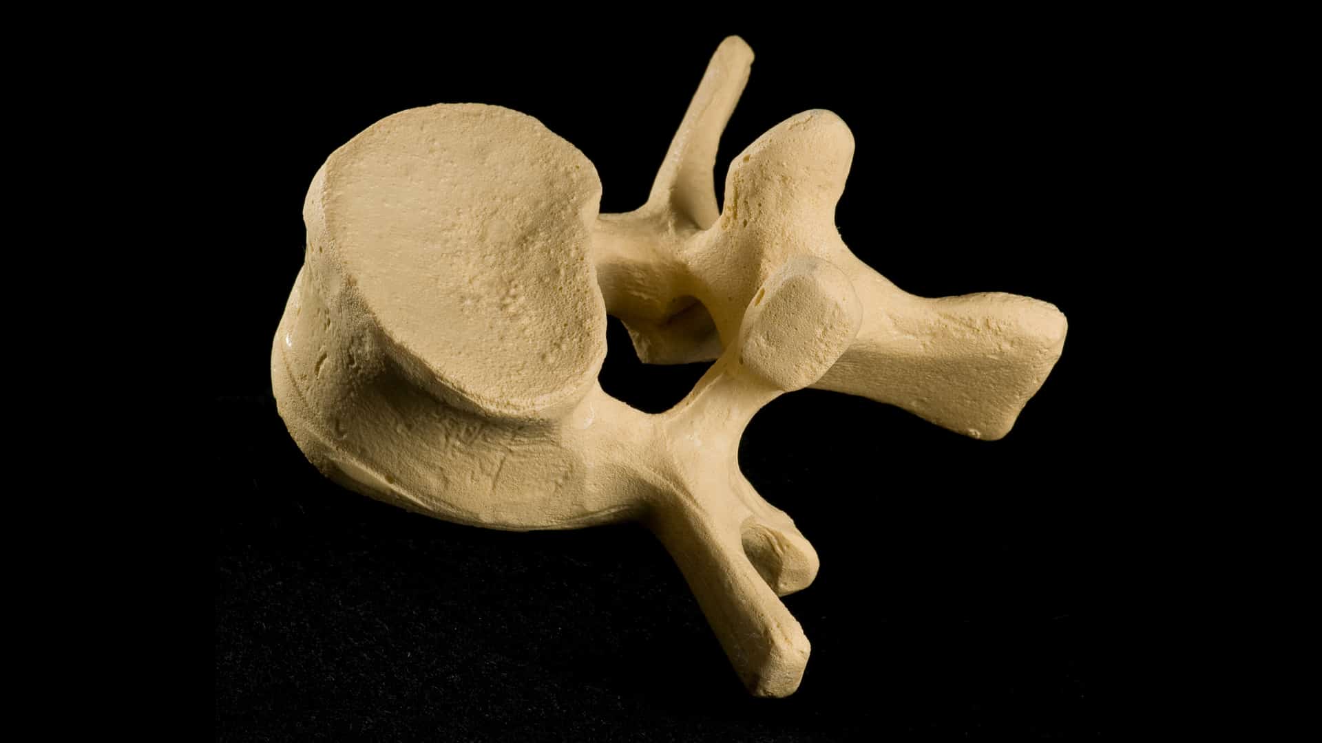 Almendras para la osteoporosis