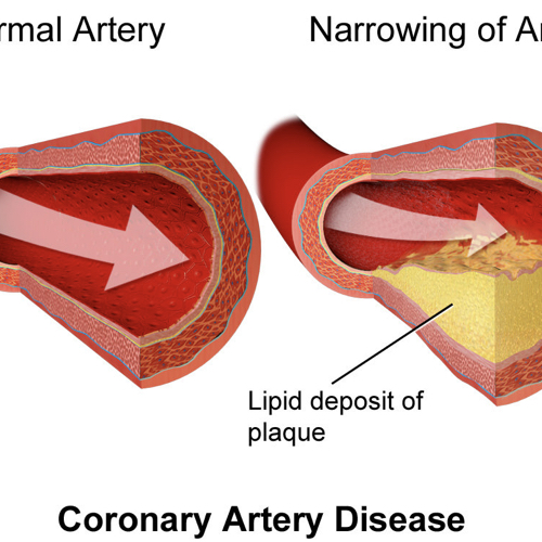 Cholesterol