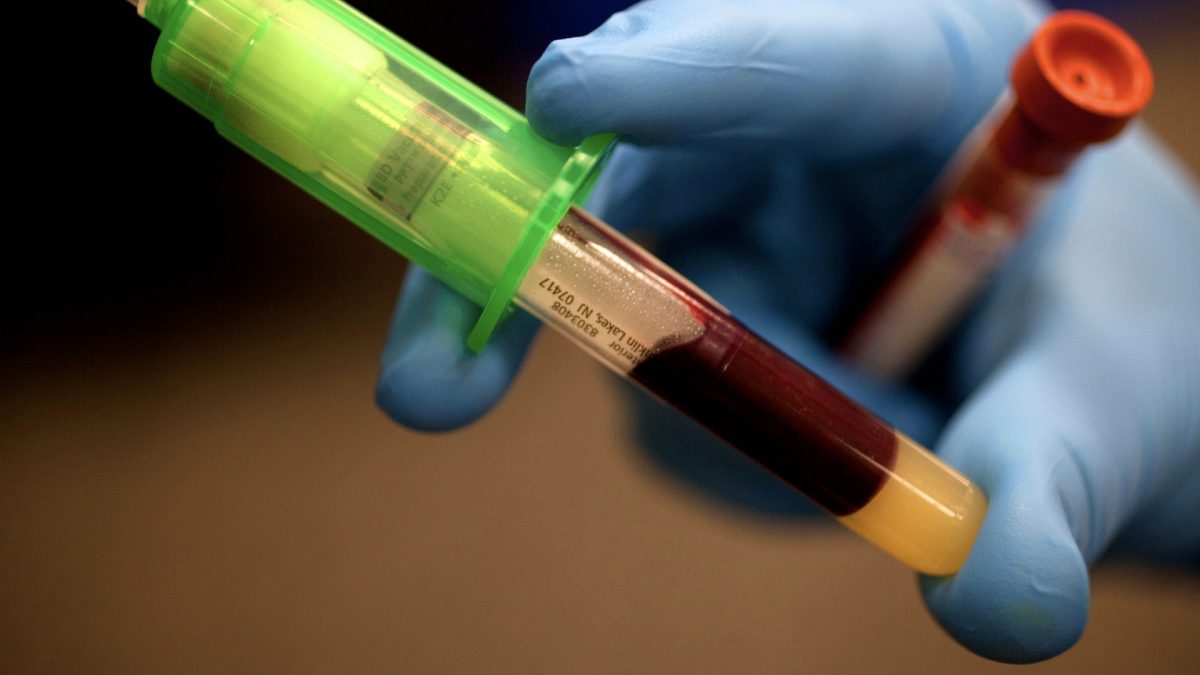 “Normal” Blood Lead Levels Can Be Toxic