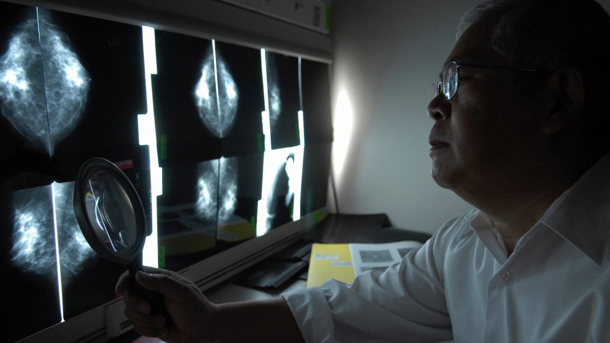 Do Mammograms Save Lives?