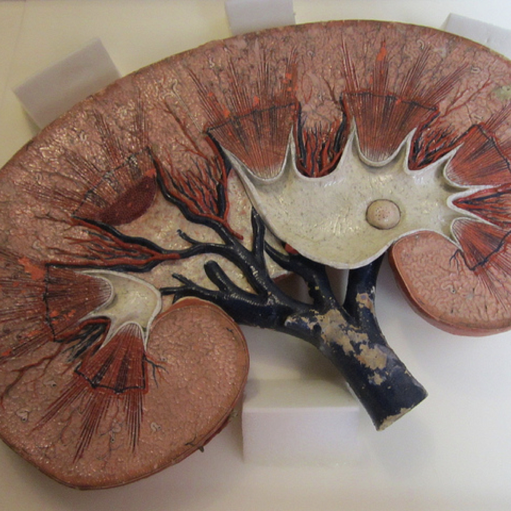 kidney health Health Topics