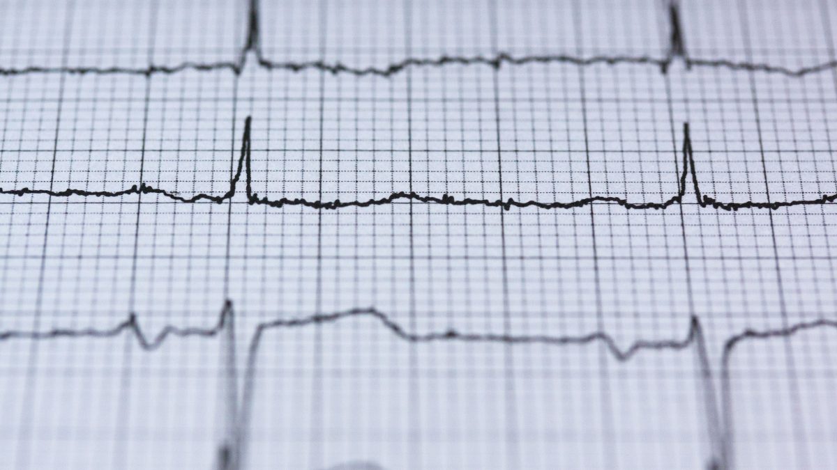 håndvask ulykke ankomme One Heartbeat per Second to Beat the Clock