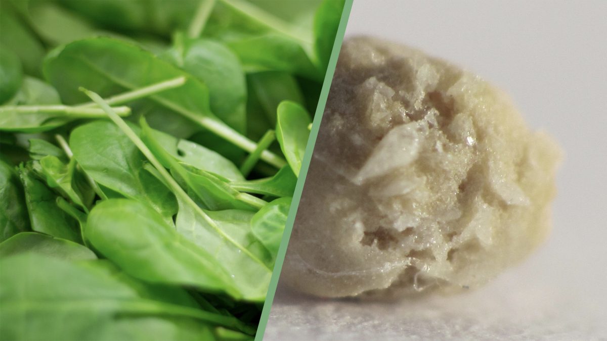 Oxalates in Spinach and Kidney Stones Should We Be Concerned?