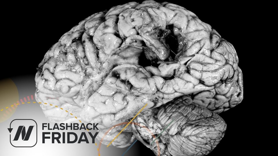 Flashback Friday: How to Prevent a Stroke