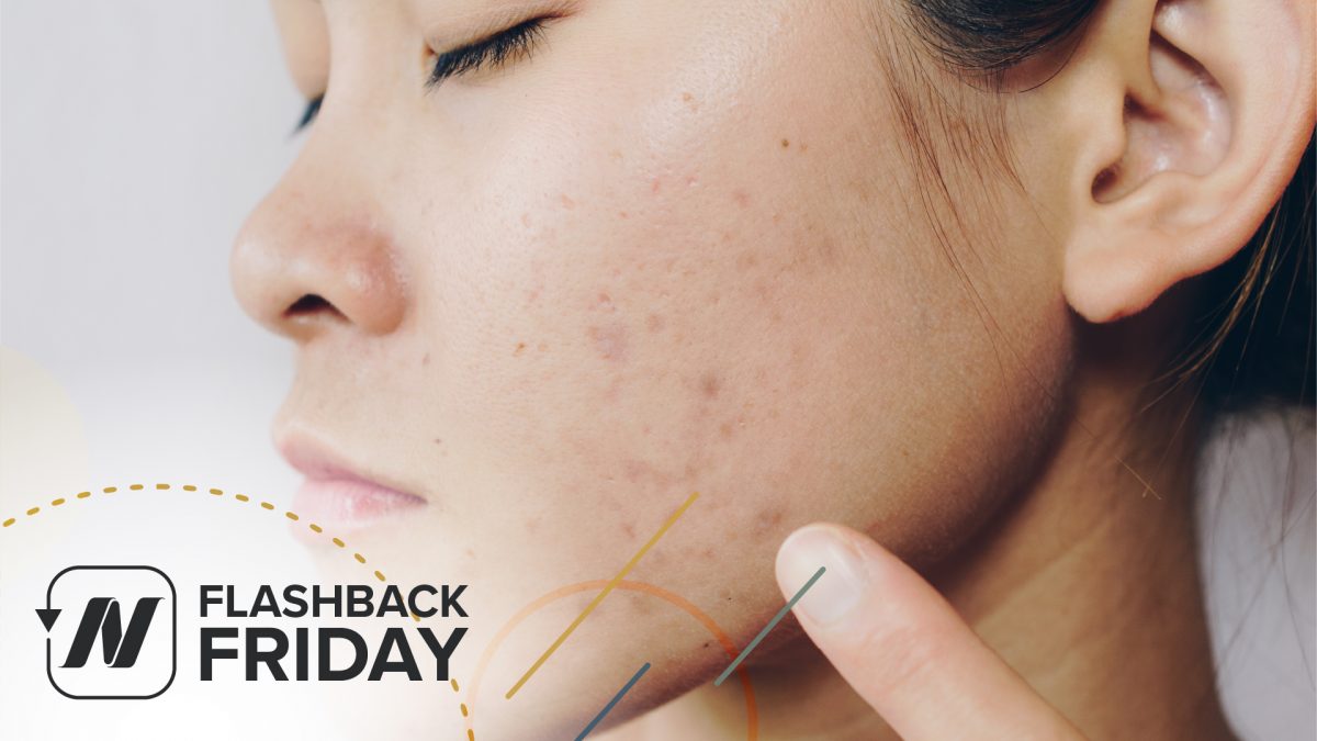 FBF - Saving Lives by Treating Acne with Diet