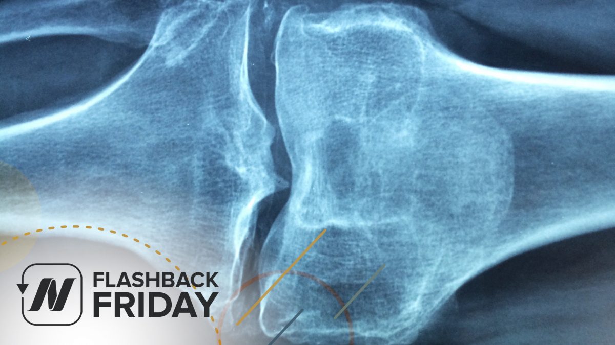 Flashback Friday: Sesame Seeds for Knee Osteoarthritis