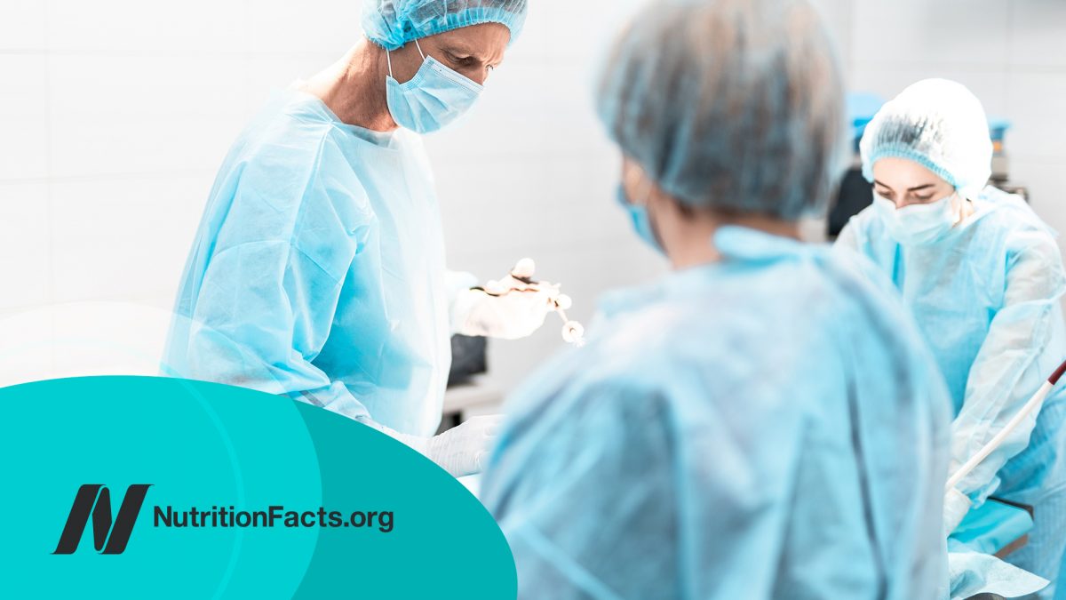 doctor in protective mask performing surgery while assistants help him