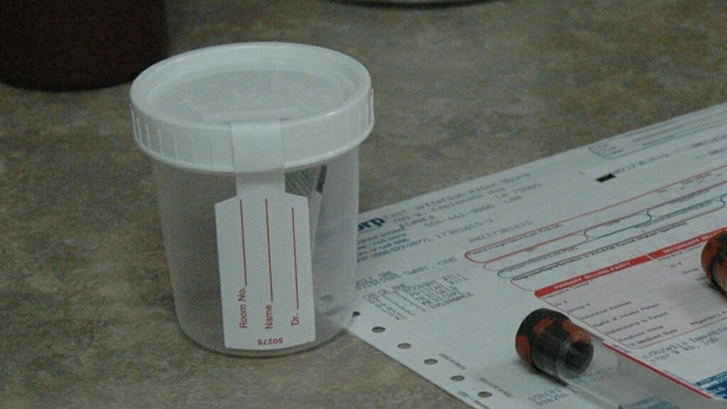 Are Provoked Urine Challenge Tests for Heavy Metals a Scam?