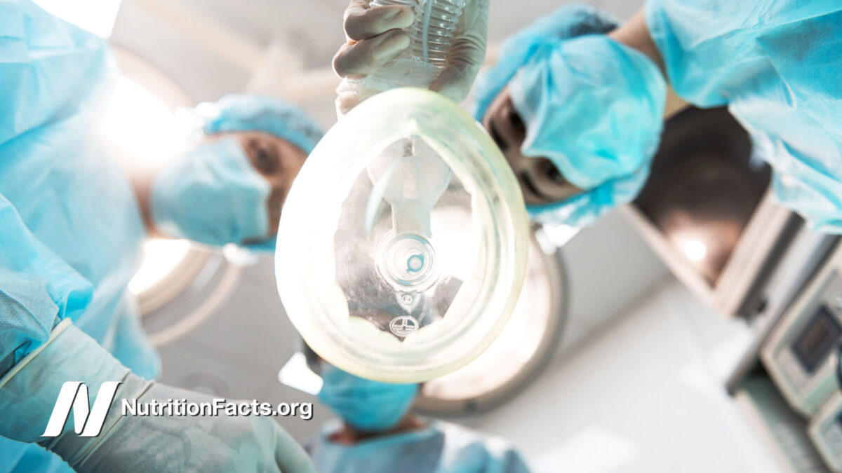 bottom view of three doctors leaning over the patient holding anesthetic inhaler