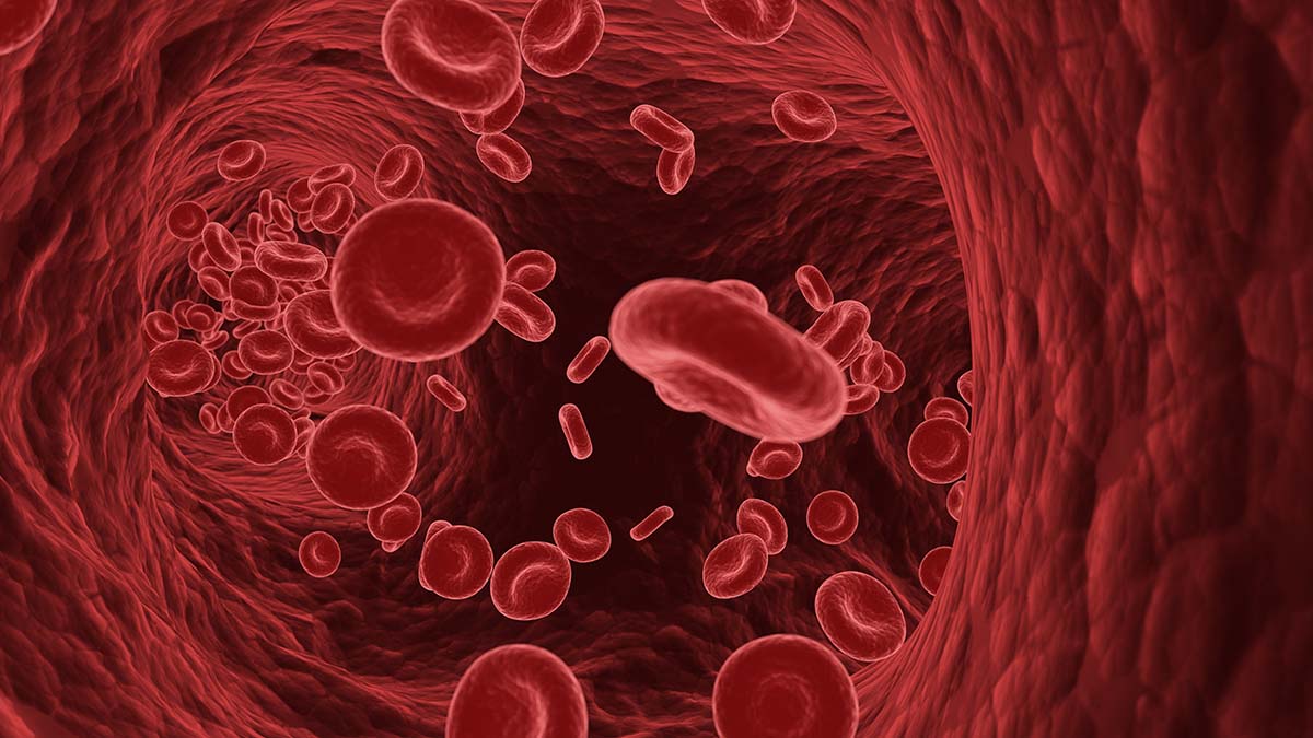 Egg Consumption and LDL Cholesterol Size