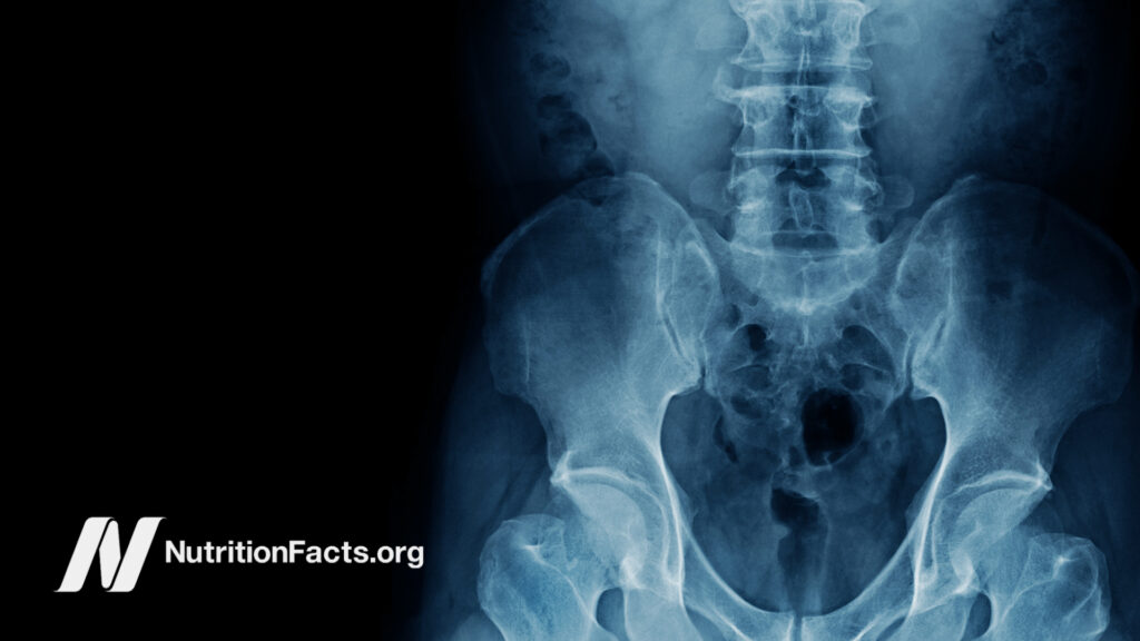 X-ray image of human standing