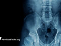X-ray image of human standing