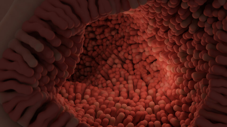 Secretin for Autism