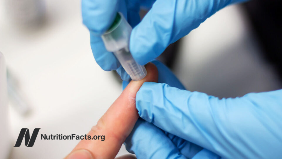 Gloved hand doing a finger prick on another person’s hand