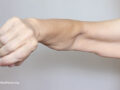 loose muscle on an arm of a senior elderly woman