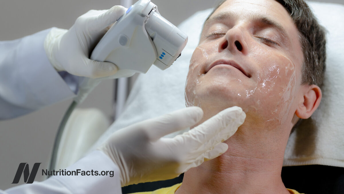 Technician performing skin resurfacing procedure on male client