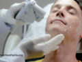 Technician performing skin resurfacing procedure on male client