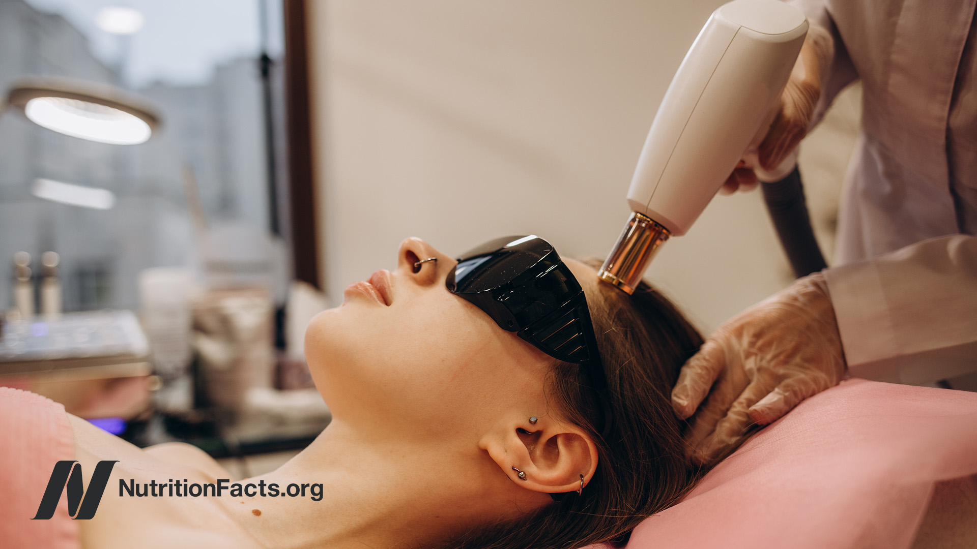 Woman undergoing laser therapy at the hairline