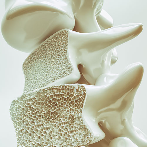 new research on osteoporosis