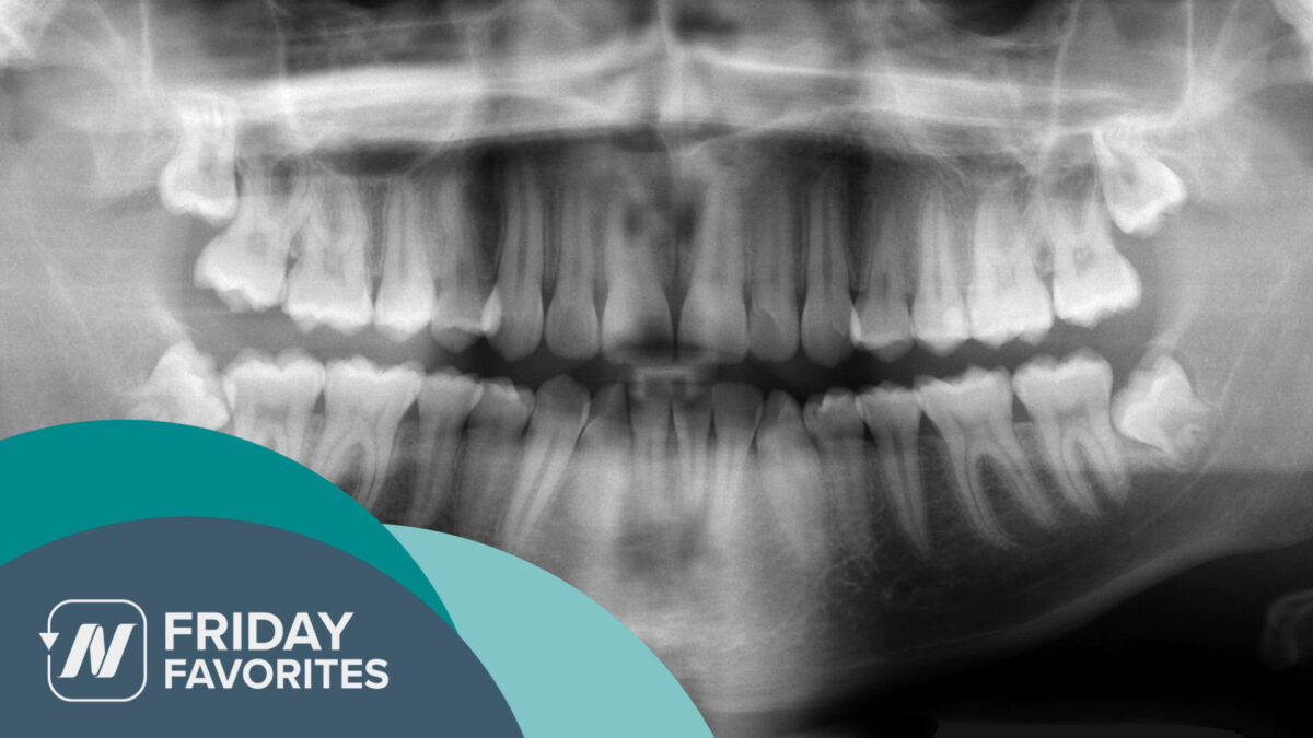 dental x-ray