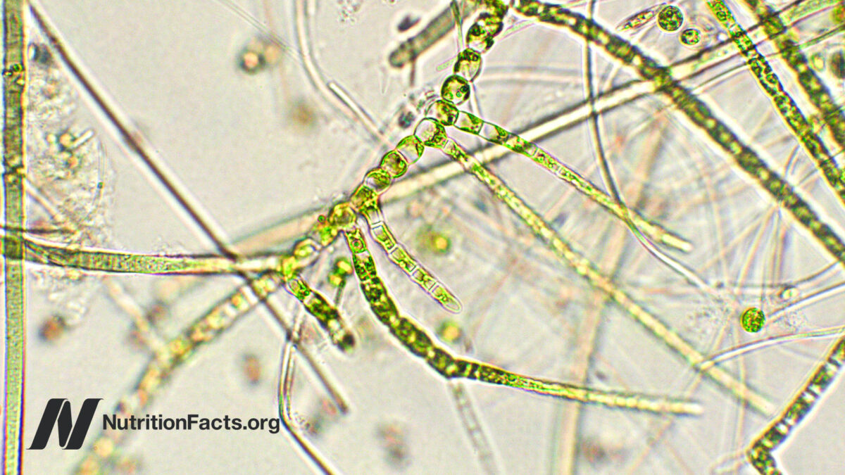 Algae from a microscopic view