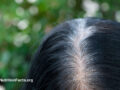 Greying hairs from the root