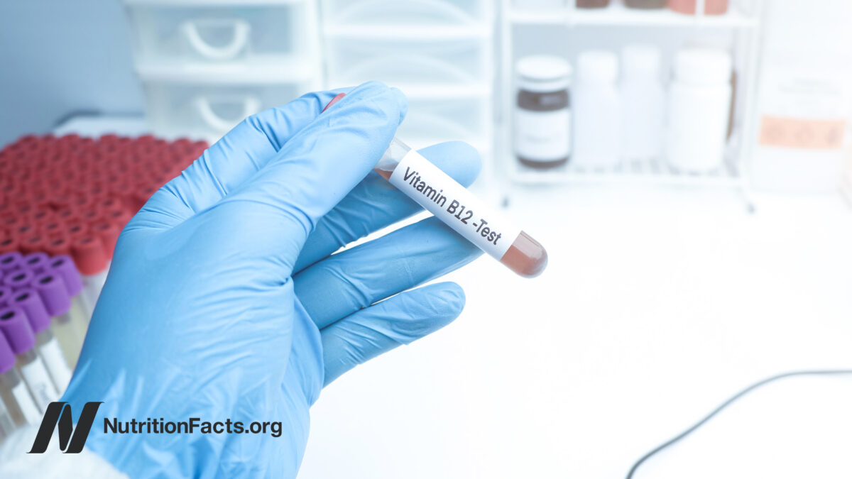 Hand with blue nitrile glove holding up a medical tube with the label “Vitamin B12 Test”