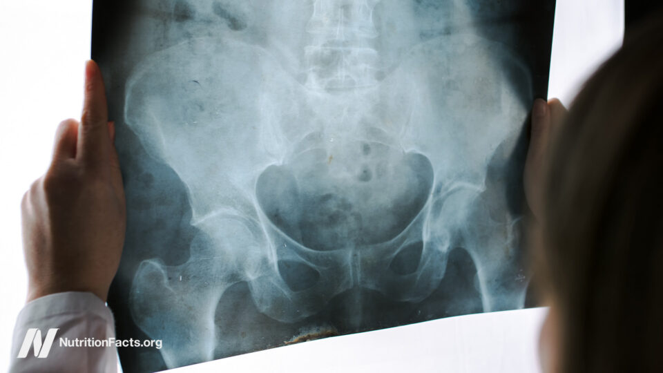 “An Outrageous Assault”: Pelvic Exams by Med Students on Anesthetized Women