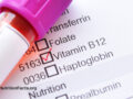 Closeup view of a blood test form with a checkmark next to Vitamin B12
