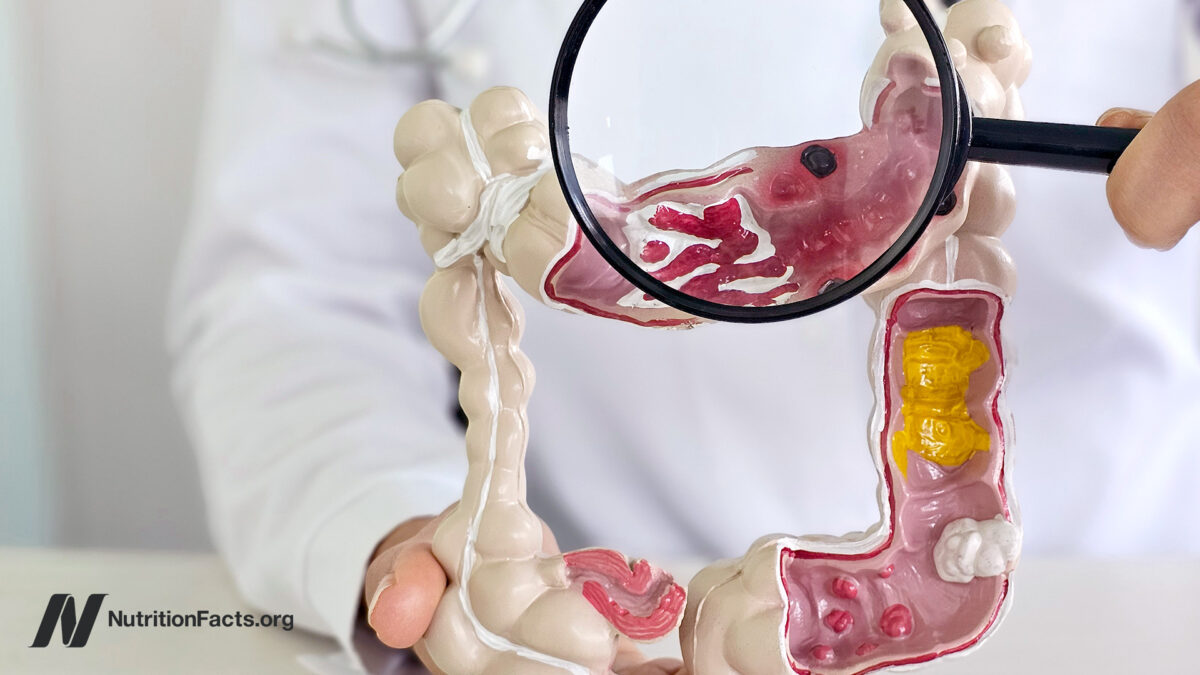 health professional with a magnifying glass examining a model of the digestive tract