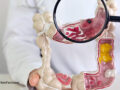 health professional with a magnifying glass examining a model of the digestive tract
