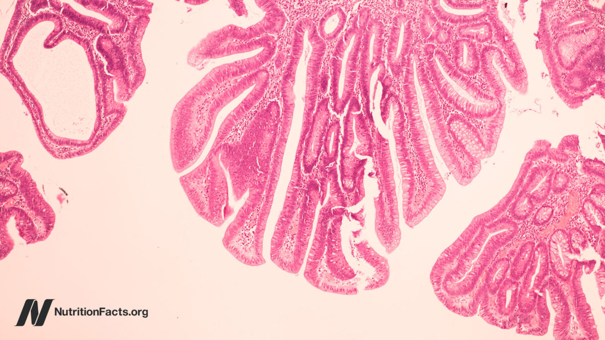 Could Bovine Leukemia Virus be a Cause of Breast Cancer?